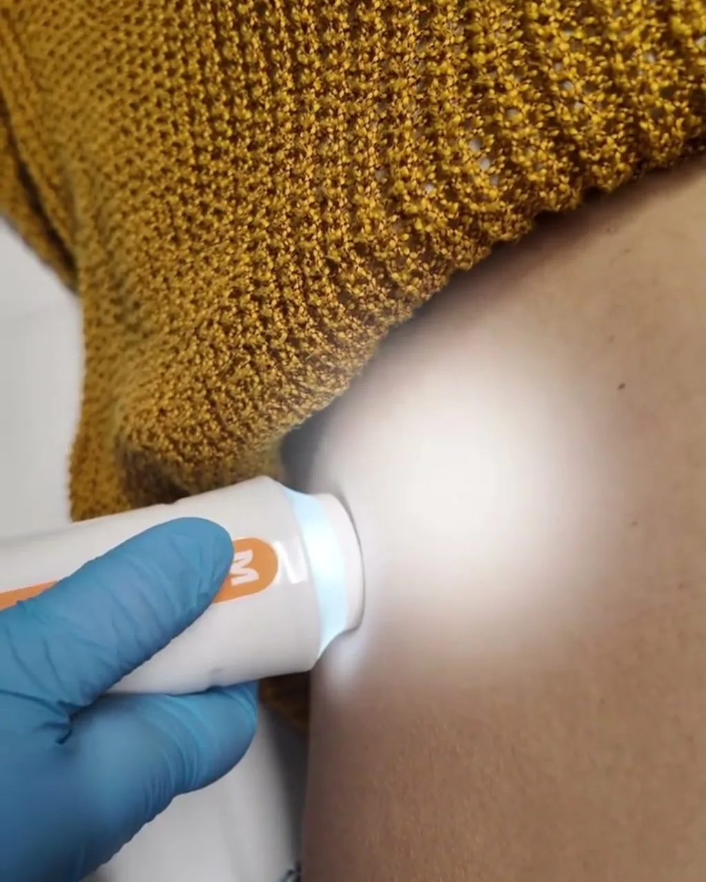 Sonda del FibroScan® aplicada sobre el abdomen de una paciente, con guante azul de exploración.
